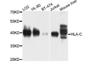 Western blot analysis of extracts of various cells, using HLA-C antibody. (HLA-C 抗体)