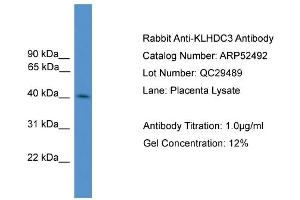 WB Suggested Anti-KLHDC3  Antibody Titration: 0. (KLHDC3 抗体  (N-Term))