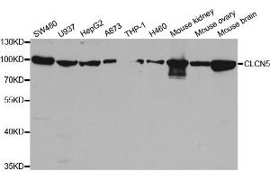 Western blot analysis of extracts of various cell lines, using CLCN5 antibody (ABIN5973337) at 1/1000 dilution. (Chloride Channel 5 抗体)