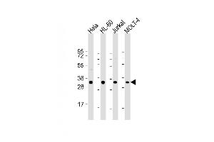 All lanes : Anti-OPN-a/b Antibody (N-term) at 1:2000 dilution Lane 1: Hela whole cell lysate Lane 2: HL-60 whole cell lysate Lane 3: Jurkat whole cell lysate Lane 4: MOLT-4 whole cell lysate Lysates/proteins at 20 μg per lane. (OPN-A,b (AA 14-40), (N-Term) 抗体)
