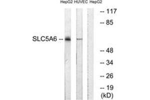 Western Blotting (WB) image for anti-Solute Carrier Family 5 (Iodide Transporter), Member 6 (SLC5A6) (AA 551-600) antibody (ABIN1535388)