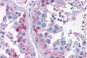 Immunohistochemistry (IHC) image for anti-Cytochrome P450, Family 26, Subfamily B, Polypeptide 1 (CYP26B1) (Internal Region) antibody (ABIN185731)