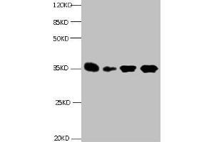 All lanes: Mouse anti- Human Insulin-like growth factor-binding protein 1 monoclonal antibody at 1 μg/mL Lane 1:Pyrolysis liquid human placental tissue 7. (IGFBPI 抗体)