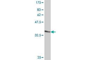 Western Blot detection against Immunogen (36. (PPIL1 抗体  (AA 76-166))