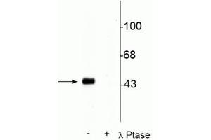 Western blot of rat hippocampal lysate stimulated with forskolin showing specific immunolabeling of the ~45 kDa CREB phosphorylated at Ser133 in the first lane (-). (CREB1 抗体  (pSer133))