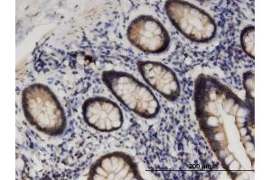Immunoperoxidase of monoclonal antibody to STK38L on formalin-fixed paraffin-embedded human small Intestine. (STK38L 抗体  (AA 1-464))