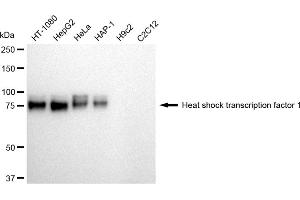 Western blotting analysis using Heat shock transcription factor 1 antibody (ABIN7798861).