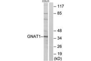 Western blot analysis of extracts from COLO cells, using GNAT1 Antibody. (GNAT1 抗体  (AA 71-120))