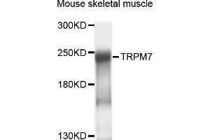 Western blot analysis of extracts of mouse skeletal muscle, using TRPM7 antibody (ABIN4905504) at 1:1000 dilution. (TRPM7 抗体)