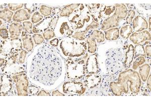 Immunohistochemical analysis of paraffin-embedded Human kidney section using Pink1 (ABIN1538954 and ABIN2849886). (FH 抗体  (N-Term))