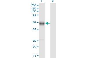 Western Blot analysis of IGHG4 expression in transfected 293T cell line by IGHG4 MaxPab polyclonal antibody. (IGHG4 抗体  (AA 1-473))