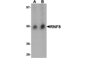 Western blot analysis of RNF8 in human lung tissue lysate with RNF8 antibody at (A) and (B) 2 μg/ml. (RNF8 抗体  (C-Term))
