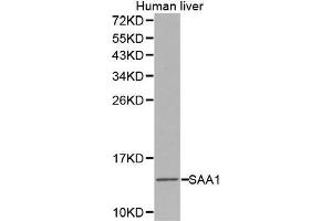 Western Blotting (WB) image for anti-Serum Amyloid A1 (SAA1) (AA 19-122) antibody (ABIN3022331) (SAA1 抗体  (AA 19-122))