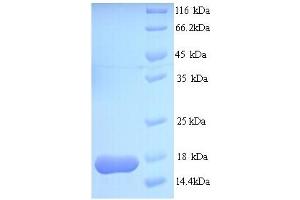 SDS-PAGE (SDS) image for ATP-Binding Cassette, Sub-Family B (MDR/TAP), Member 1B (ABCB1B) (AA 1-114), (full length) protein (His tag) (ABIN4974034)
