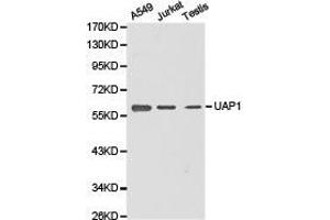 Western Blotting (WB) image for anti-UDP-N-Acteylglucosamine Pyrophosphorylase 1 (UAP1) antibody (ABIN1875243) (UAP1 抗体)