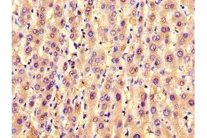 Immunohistochemistry (IHC) image for anti-Solute Carrier Family 25 (Mitochondrial Carrier, Adenine Nucleotide Translocator), Member 6 (SLC25A6) (AA 144-175) antibody (ABIN7143542)