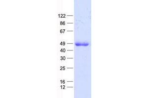 Validation with Western Blot (E2F5 Protein (E2F5) (His tag))