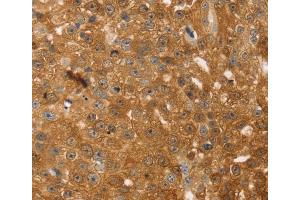 Immunohistochemistry (IHC) image for anti-Thymosin beta 10 (TMSB10) antibody (ABIN2433967) (Thymosin beta 10 抗体)