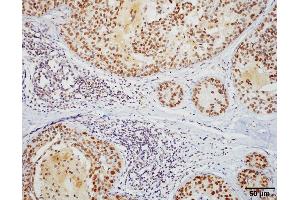 Immunohistochemistry analysis using Rat Anti-HSF1 Monoclonal Antibody, Clone 10H8 .