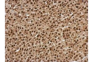 Image no. 1 for anti-B-Cell CLL/lymphoma 7C (BCL7C) (AA 1-215) antibody (ABIN1496855) (BCL7C 抗体  (AA 1-215))