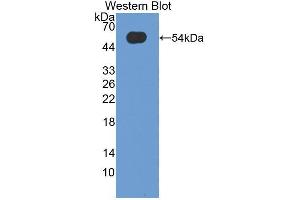 Western blot analysis of the recombinant protein. (Oncostatin M 抗体  (AA 26-220))