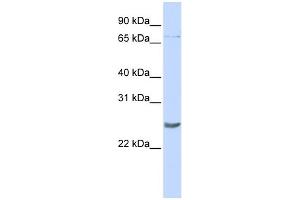 WB Suggested Anti-PRDM5 Antibody Titration:  0. (PRDM5 抗体  (Middle Region))
