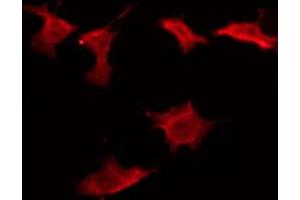 ABIN6274594 staining Hela by IF/ICC. (CD160 抗体  (Internal Region))