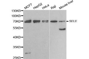 Western blot analysis of extracts of various cell lines, using SELE antibody. (Selectin E/CD62e 抗体)