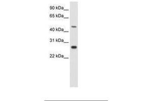 Image no. 1 for anti-Spermatogenic Leucine Zipper 1 (SPZ1) (C-Term) antibody (ABIN202383) (SPZ1 抗体  (C-Term))