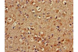 Immunohistochemistry of paraffin-embedded human brain tissue using ABIN7174052 at dilution of 1:100 (TYRO3 抗体  (AA 728-873))