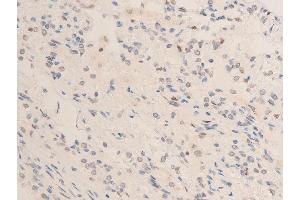 ABIN6267253 at 1/100 staining human TB tissue sections by IHC-P. (CHEK2 抗体  (pThr68))