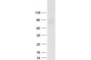 Western Blotting (WB) image for Ciliary Neurotrophic Factor Receptor (CNTFR) (Transcript Variant 1) protein (Myc-DYKDDDDK Tag) (ABIN2712919)
