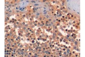 Detection of CD34 in Human Tonsil Tissue using Polyclonal Antibody to Cluster Of Differentiation 34 (CD34)