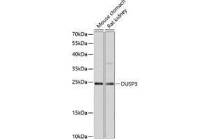 Western blot analysis of extracts of various cell lines, using DUSP3 antibody (ABIN6127792, ABIN6139873, ABIN6139874 and ABIN6215639) at 1:3000 dilution. (Dual Specificity Phosphatase 3 (DUSP3) (AA 1-185) 抗体)