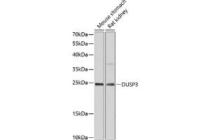 Western blot analysis of extracts of various cell lines, using DUSP3 antibody (ABIN6127792, ABIN6139873, ABIN6139874 and ABIN6215639) at 1:3000 dilution.