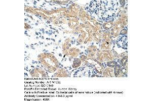 Rabbit Anti-NXF5 Antibody  Paraffin Embedded Tissue: Human Kidney Cellular Data: Epithelial cells of renal tubule Antibody Concentration: 4. (NXF5 抗体  (Middle Region))