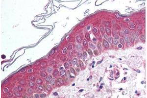 Anti-WNT10B antibody  ABIN1049469 IHC staining of human skin.