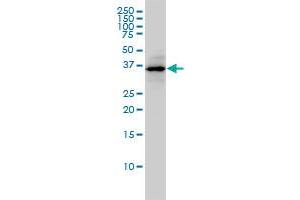 Western Blotting (WB) image for anti-Malate Dehydrogenase 1, NAD (Soluble) (MDH1) (AA 1-334) antibody (ABIN561768)