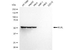 Western blotting analysis using MLKL antibody (ABIN7799478).