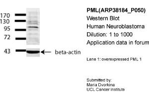 Western Blotting (WB) image for anti-Promyelocytic Leukemia (PML) (Middle Region) antibody (ABIN2778427) (PML 抗体  (Middle Region))