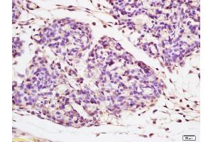 Formalin-fixed and paraffin embedded mouse embryo tissue labeled with Anti-Beta galactosidase Polyclonal Antibody, Unconjugated (ABIN1386129) at 1:200 followed by conjugation to the secondary antibody and DAB staining (GLB1 抗体  (AA 301-380))