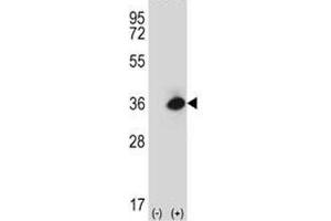 Western Blotting (WB) image for anti-Advanced Glycosylation End Product-Specific Receptor (AGER) (AA 76-104) antibody (ABIN3029883)