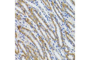 Immunohistochemistry of paraffin-embedded mouse kidney using HEXA antibody (ABIN6290114) at dilution of 1:100 (40x lens). (Hexosaminidase A 抗体)