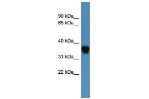 Western Blot showing AKR1C1 antibody used at a concentration of 1-2 ug/ml to detect its target protein. (AKR1C1 抗体  (N-Term))