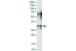 Immunoprecipitation of CLTB transfected lysate using anti-CLTB MaxPab rabbit polyclonal antibody and Protein A Magnetic Bead , and immunoblotted with CLTB purified MaxPab mouse polyclonal antibody (B01P) . (CLTB 抗体  (AA 1-211))