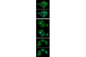 anti-Adenylate Kinase 1 (AK1) (AA 1-194) antibody