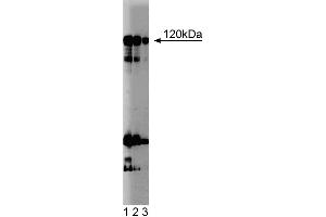 Western blot analysis of NFAT-1 on a Jurkat cell lysate (Human T-cell leukemia, ATCC TIB-152). (NFAT1 抗体  (AA 29-181))