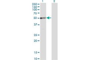 Western Blot analysis of TRIP6 expression in transfected 293T cell line by TRIP6 monoclonal antibody (M07), clone 3D12. (TRIP6 抗体  (AA 1-100))