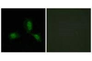 Immunofluorescence analysis of HeLa cells, using IRS-1 (Ab-312) antibody.