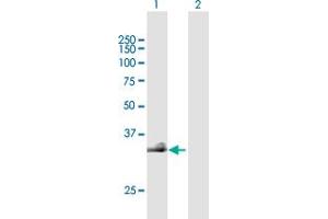 Western Blot analysis of HAS3 expression in transfected 293T cell line by HAS3 MaxPab polyclonal antibody. (HAS3 抗体  (AA 1-281))